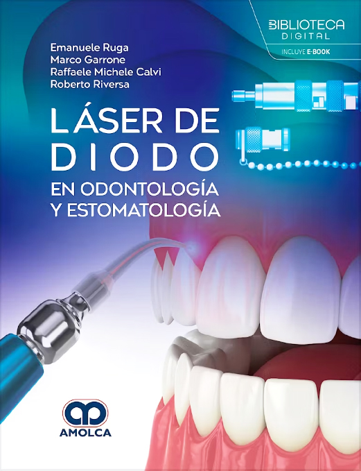 Láser de Diodo en Odontología y Estomatología